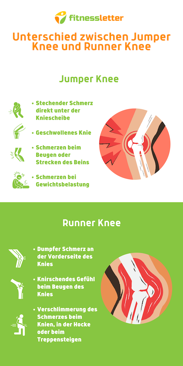 Unterschied Jumper Knee & Runner Knee