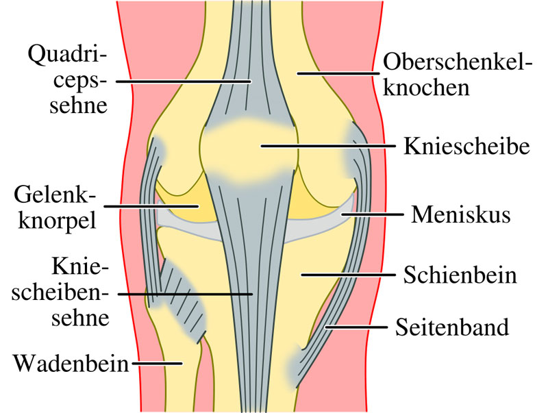 Knieverletzungen entstehen häufig durch falsche oder zu starke Belastung.
